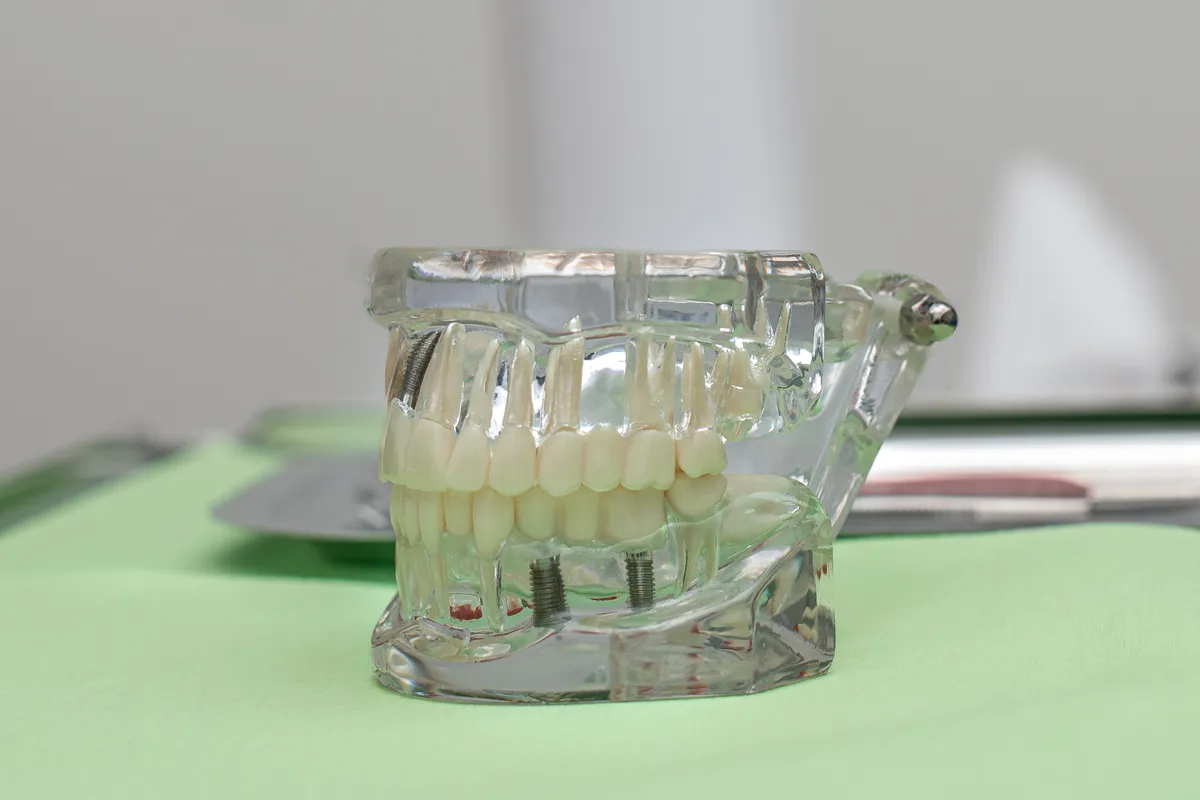 Klinika ProMag Dental – foto 11